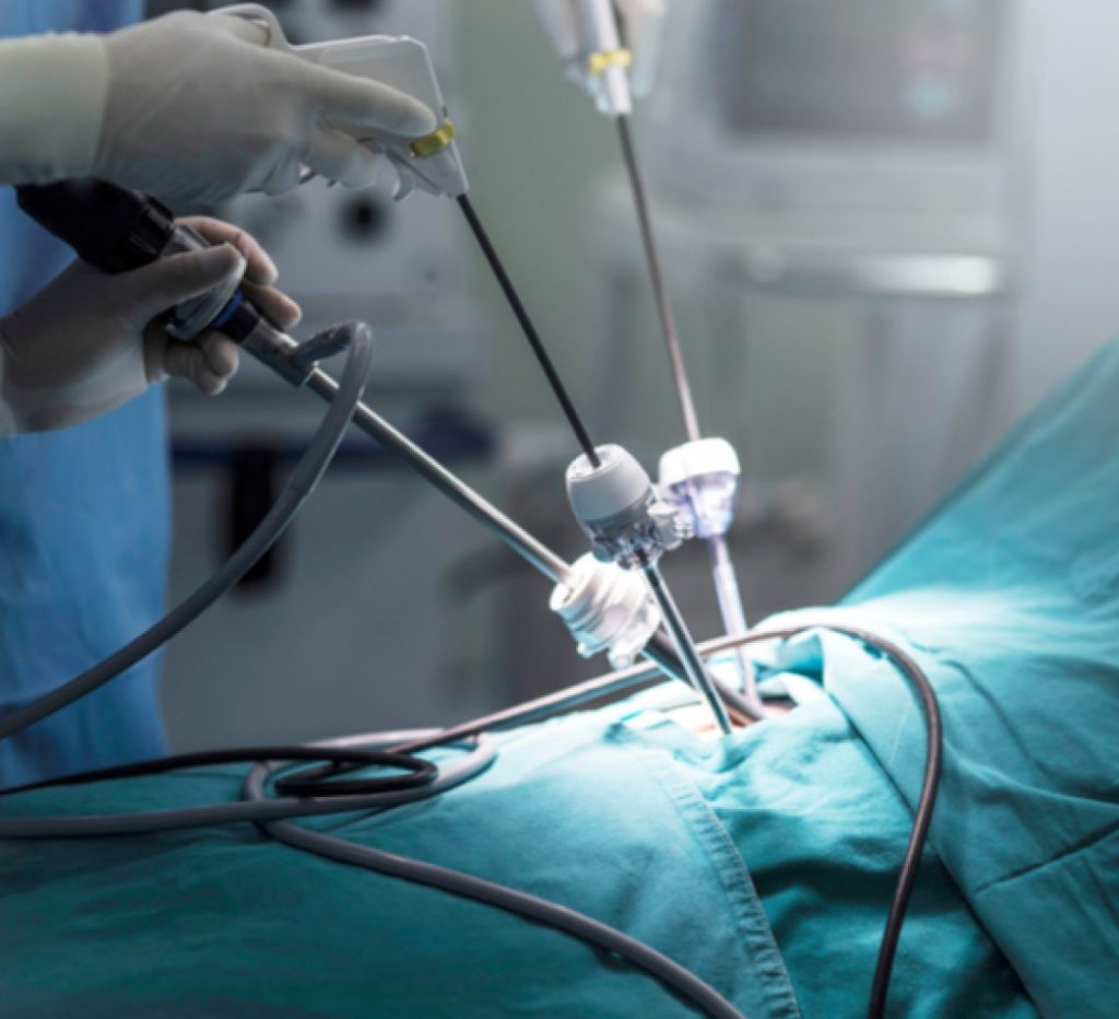 Laparoscopic Surgery/Minimal Access Surgery – Dr. Mark Surgical Clinic